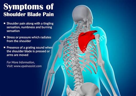 Frequently when the muscles and joints about the neck become irritated, pain will radiate to the shoulder blade, upper trap, or arm. . Burning pain in neck and shoulder blade